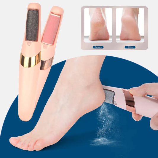 Machine de pédicure électrique rechargeable pour enlever les callosités des pieds