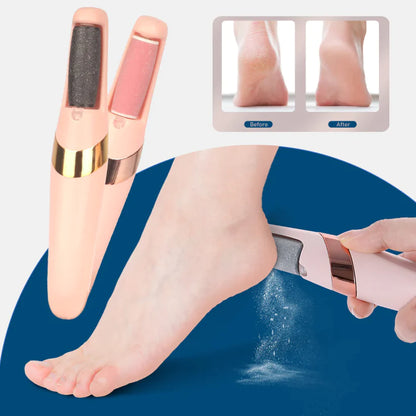 Machine de pédicure électrique rechargeable pour enlever les callosités des pieds